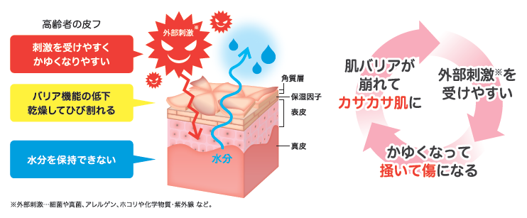 高齢者の皮膚